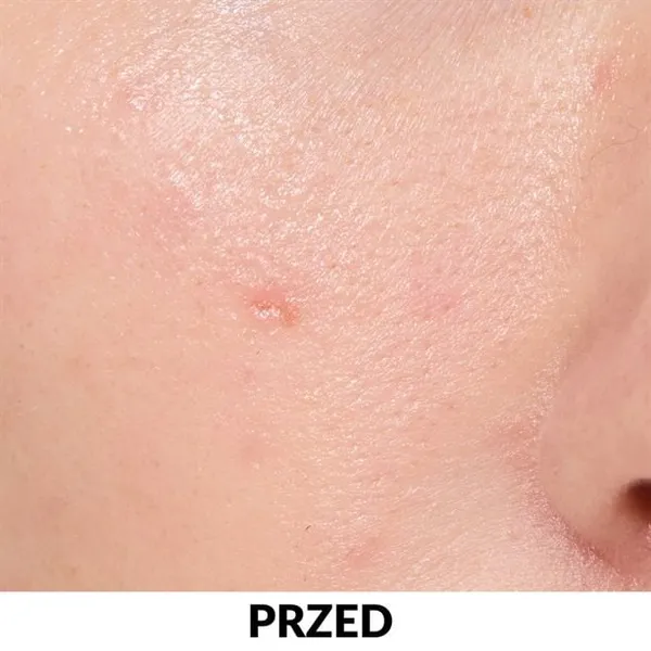 Multipeptydowe serum regulująco-nawilżające Anew 30 ml AVON – zdjęcie 3