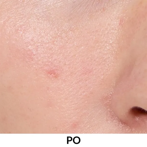 Multipeptydowe serum regulująco-nawilżające Anew 30 ml AVON – zdjęcie 4