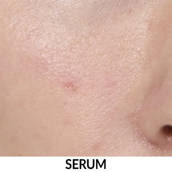 Multipeptydowe serum regulująco-nawilżające Anew 30 ml AVON – zdjęcie 5